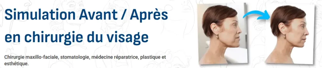 chirurgie-avant-apres.fr